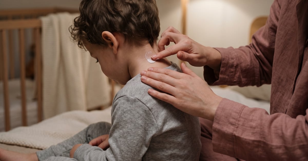 Dermatitis atópica: casi la mitad de los pacientes argentinos pospone consultas por razones económicas, según un relevamiento de AEPSO