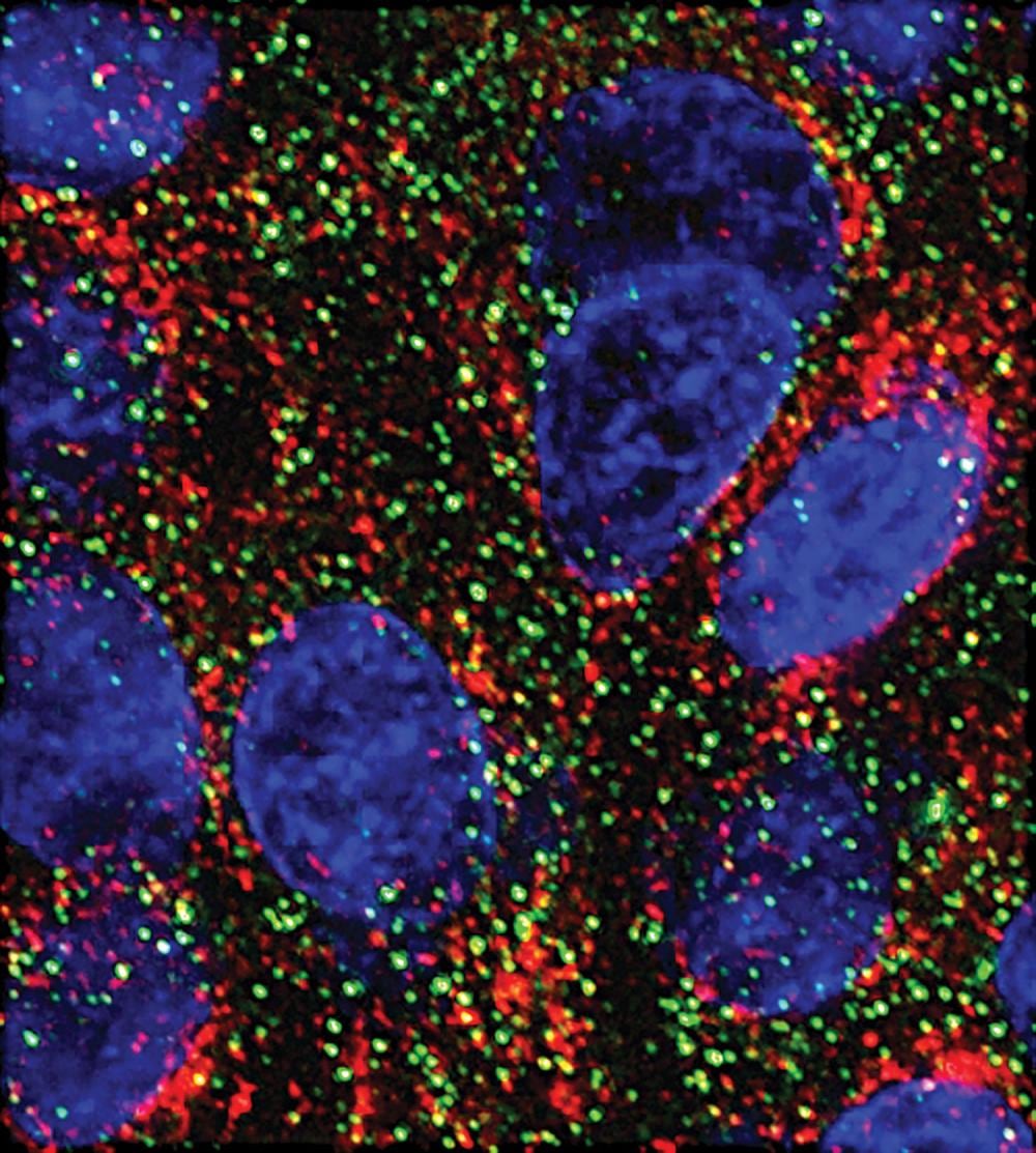 MicroARNpierden terreno en el cáncer de páncreas y abren una vía de investigación